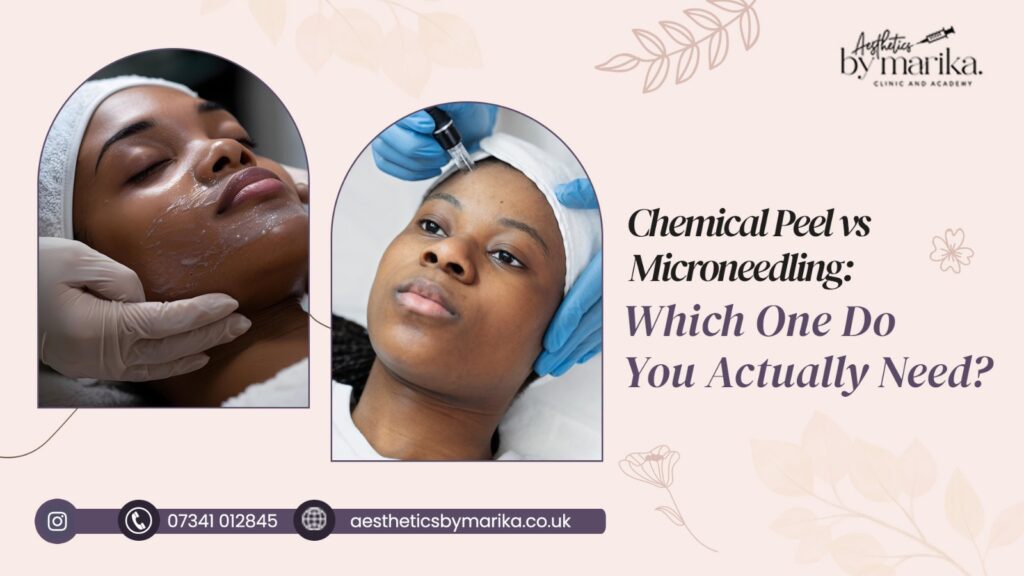 chemical peels