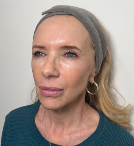 WhatsApp Image 2026-02-09 at 7.30.31 PM